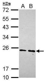 MRPS23 Antibody in Western Blot (WB)