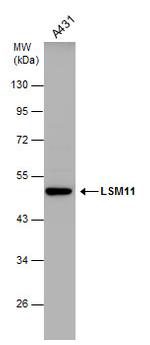 LSM11 Polyclonal Antibody