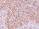 ARHGAP5 Polyclonal Antibody