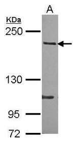 ARHGAP5 Antibody in Western Blot (WB)