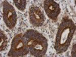 C21orf2 Antibody in Immunohistochemistry (Paraffin) (IHC (P))