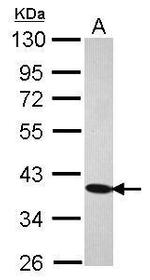 C21orf2 Antibody in Western Blot (WB)