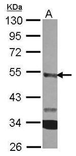 Carboxypeptidase A3 Polyclonal Antibody