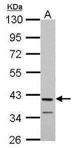 MAB21L1 Polyclonal Antibody