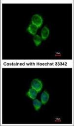SLC22A18AS Antibody in Immunocytochemistry (ICC/IF)