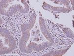 SLC22A18AS Antibody in Immunohistochemistry (Paraffin) (IHC (P))