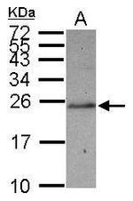 SLC22A18AS Antibody in Western Blot (WB)