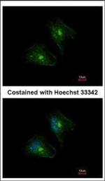 PTPRH Polyclonal Antibody