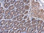 PTPRH Antibody in Immunohistochemistry (Paraffin) (IHC (P))