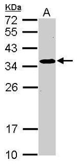 SRM Antibody in Western Blot (WB)