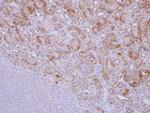 CALM Polyclonal Antibody