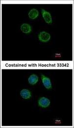 CHST2 Polyclonal Antibody