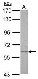 CHST2 Antibody in Western Blot (WB)