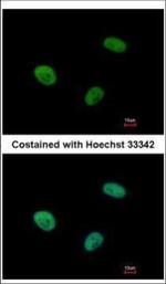 UBE3C Antibody in Immunocytochemistry (ICC/IF)