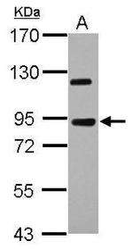 KIAA0317 Polyclonal Antibody
