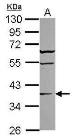 ST6GALNAC2 Antibody in Western Blot (WB)