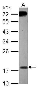 MSRB2 Polyclonal Antibody