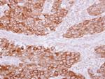 PITPNB Polyclonal Antibody