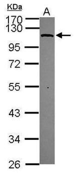 MTHFD1L Antibody in Western Blot (WB)