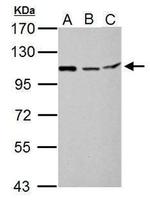 MTHFD1L Antibody in Western Blot (WB)