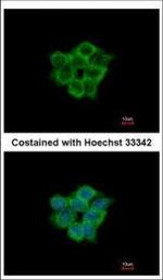 ACOT11 Polyclonal Antibody