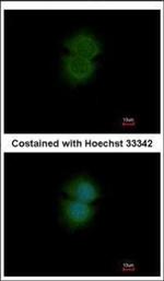 TBL2 Polyclonal Antibody
