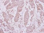VPS41 Antibody in Immunohistochemistry (Paraffin) (IHC (P))