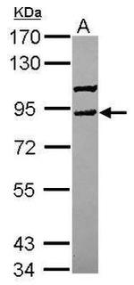 VPS41 Antibody in Western Blot (WB)