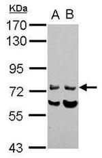 INPP5J Antibody in Western Blot (WB)