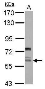 REPIN1 Polyclonal Antibody