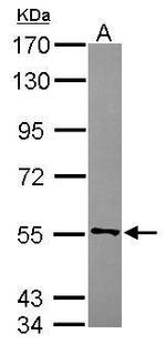CYB5R4 Polyclonal Antibody