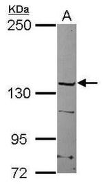 DUOX1 Antibody in Western Blot (WB)