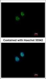NAT10 Polyclonal Antibody