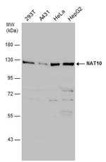 NAT10 Polyclonal Antibody
