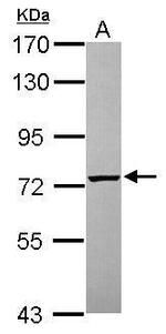 PGM2 Polyclonal Antibody