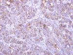 FBXL8 Polyclonal Antibody