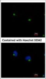 IFT122 Polyclonal Antibody