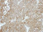 CPXM1 Polyclonal Antibody
