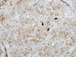 GRAMD1B Antibody in Immunohistochemistry (Paraffin) (IHC (P))