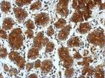 TSCOT Polyclonal Antibody