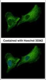 DNASE2B Polyclonal Antibody