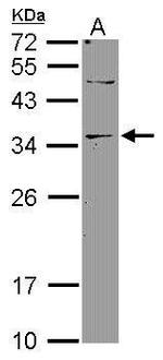 DNASE2B Antibody in Western Blot (WB)