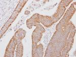 SMOC1 Polyclonal Antibody