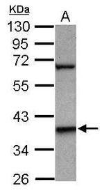LHX5 Polyclonal Antibody