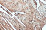 FBXL17 Polyclonal Antibody