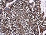 FBXL17 Antibody in Immunohistochemistry (Paraffin) (IHC (P))