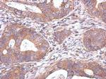 NDUFAF5 Antibody in Immunohistochemistry (Paraffin) (IHC (P))