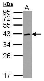 HORMAD1 Polyclonal Antibody