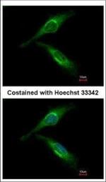 ARFGAP2 Polyclonal Antibody