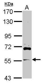 ARFGAP2 Antibody in Western Blot (WB)